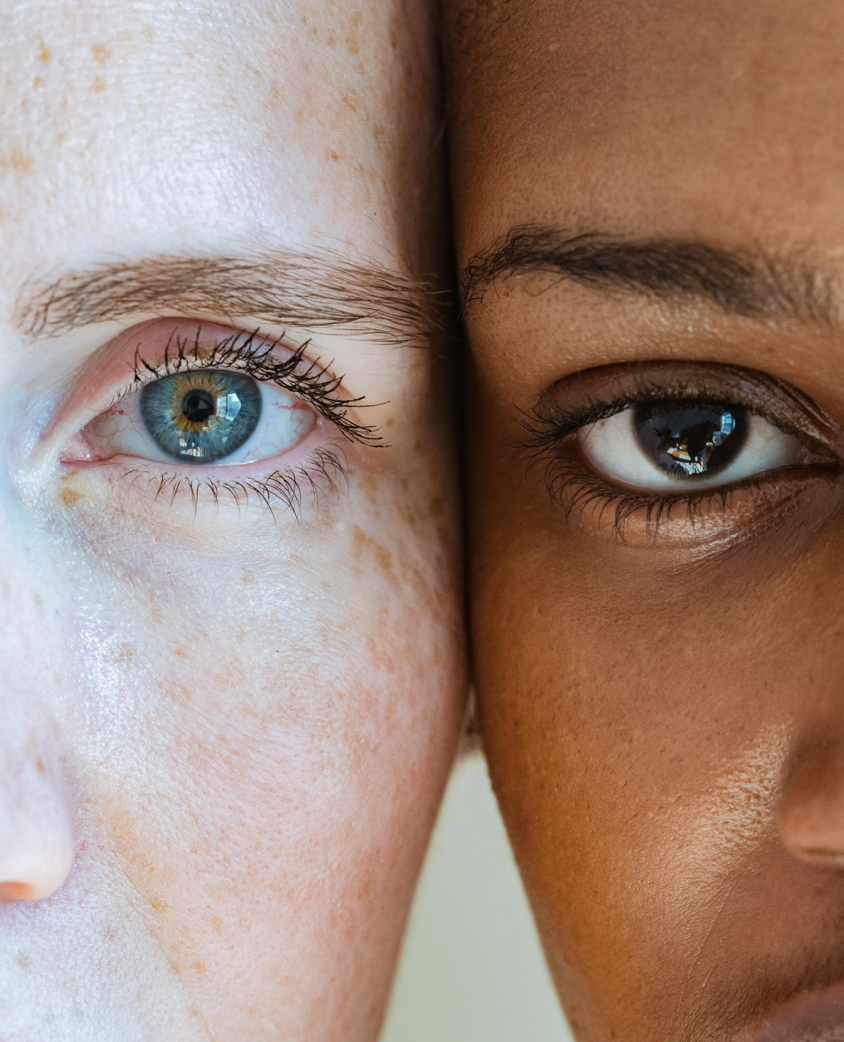 Woman with freckled face near black model